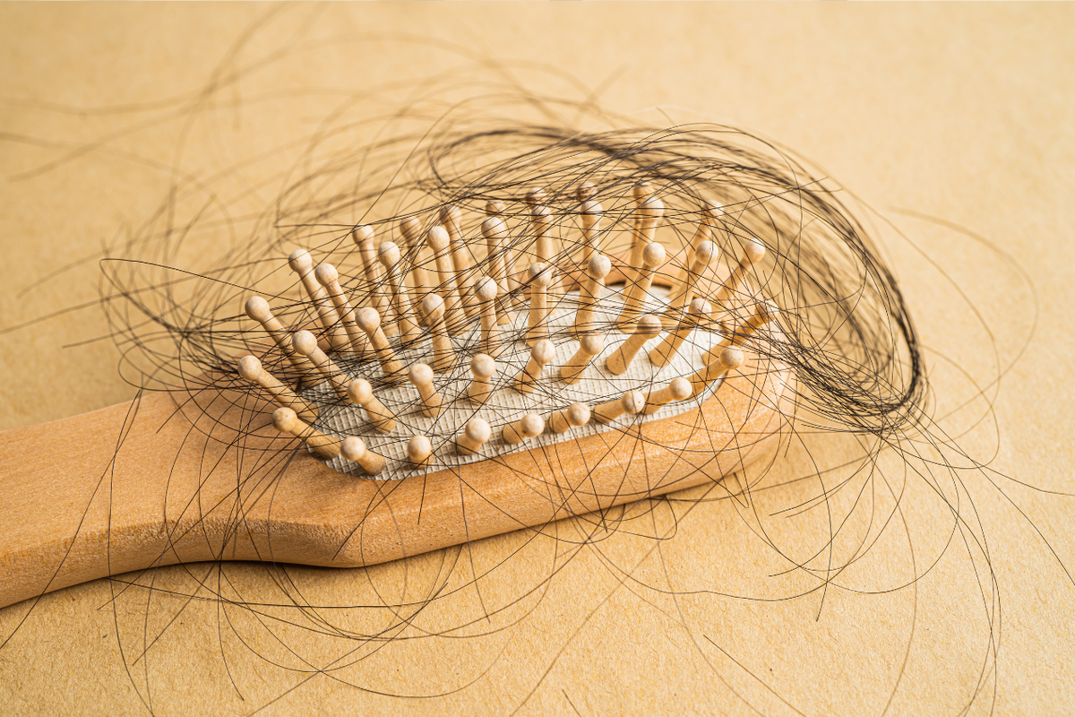 Atasi Rambut Rontok? Mulailah dengan Diagnosa Tepat Sekarang